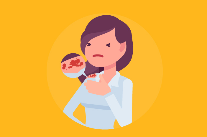 Cara mengatasi epidermolisis bulosa Cara mengatasi epidermolisis bulosa