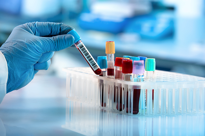penyebab terkena thalassemia, thalessemia, gangguan kelainan darah penyebab terkena thalassemia, thalessemia, gangguan kelainan darah