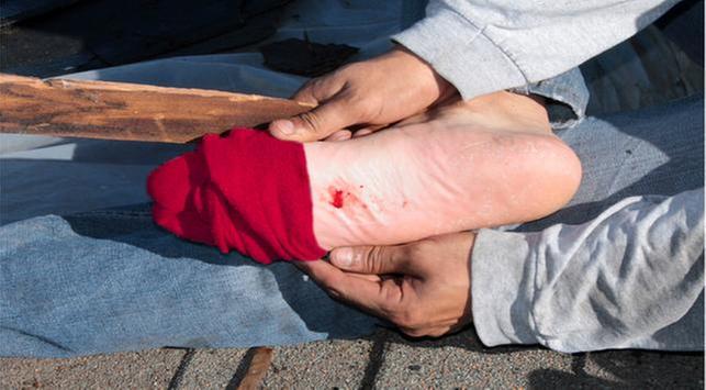 tetanus mematikan, infeksi tetanus, komplikasi tetanus, tetanus bisa mematikan tetanus mematikan, infeksi tetanus, komplikasi tetanus, tetanus bisa mematikan
