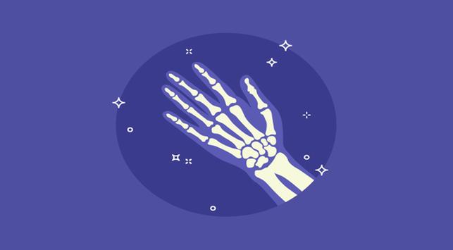 Ini Perbedaan Osteoporosis dan Osteoarthritis
