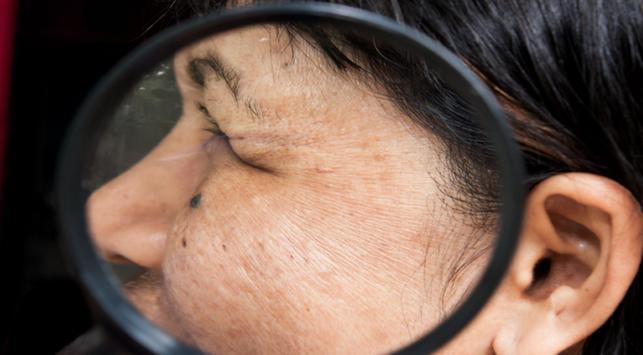 5 Faktor Penuaan Dini yang Perlu Kita Hindari