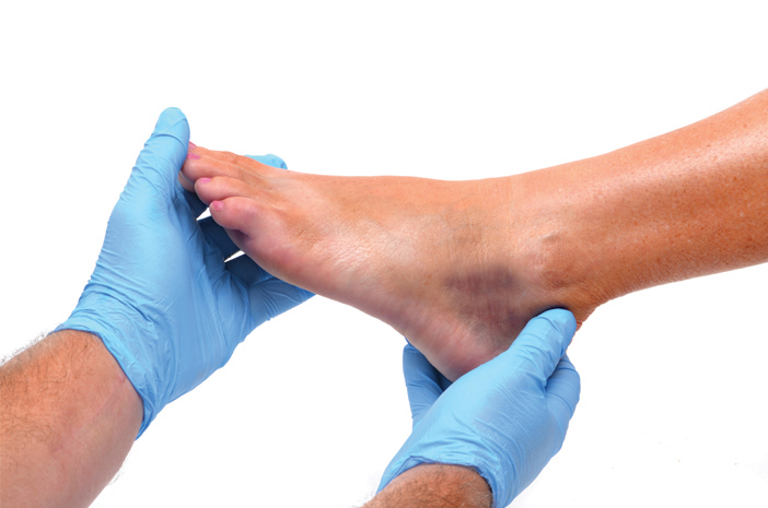 Hati-Hati Risiko Hematoma yang Berbahaya untuk Kesehatan Hati-Hati Risiko Hematoma yang Berbahaya untuk Kesehatan