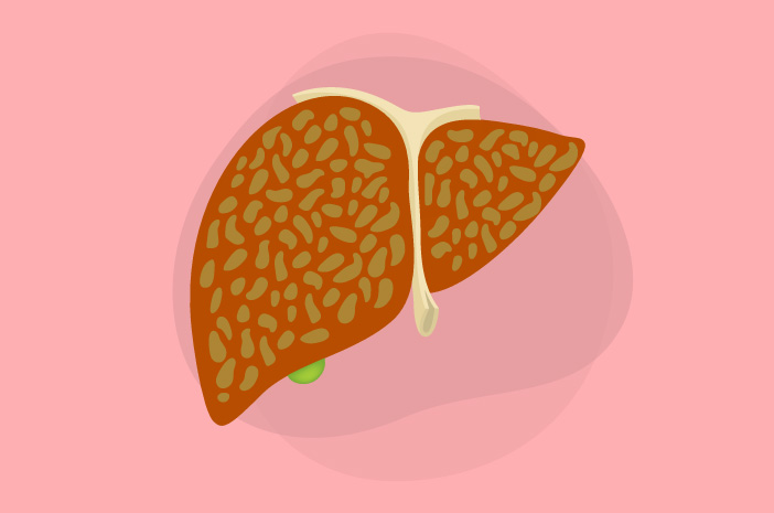 Risiko yang Bisa Ditimbulkan oleh Hepatitis C Risiko yang Bisa Ditimbulkan oleh Hepatitis C